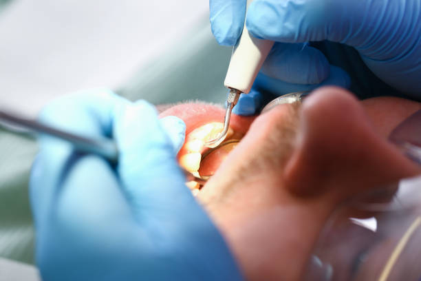 Best Emergency Dental Services for Seniors in Harvey, MI