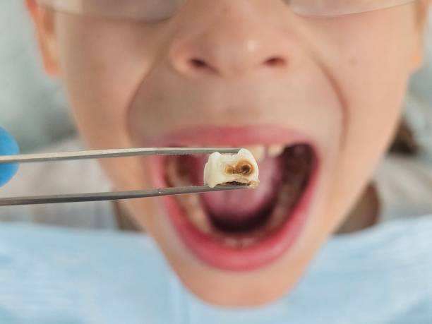 Best Weekend Emergency Dentist in Harvey, MI